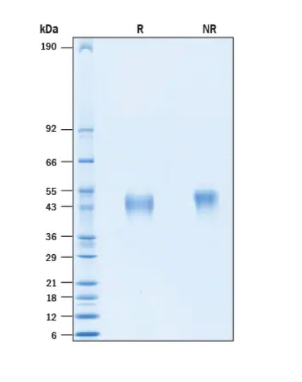 2 μg/lane Protein was resolved with SDS-PAGE under reducing (R) and non-reducing (NR) conditions and visualized by Coomassie® Blue staining.